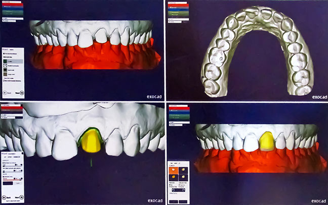 this is a Image of idiagnostics at saini dental clinic best dental clinic in jalandhar